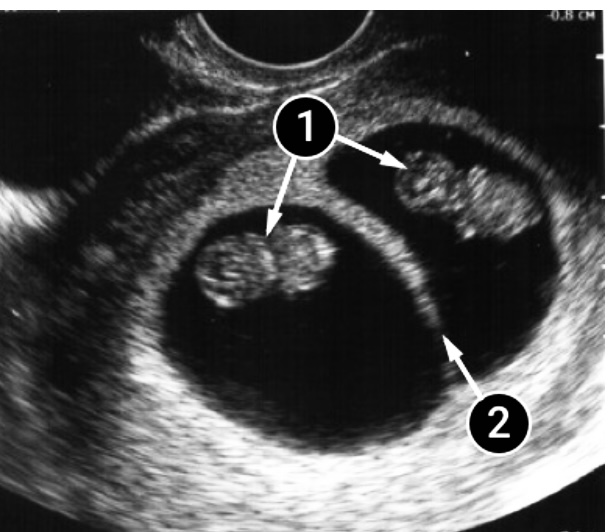 47129056 1D5B 46CE 92C1 F2E4B914FB98