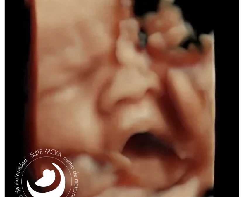 Ecografía 5D