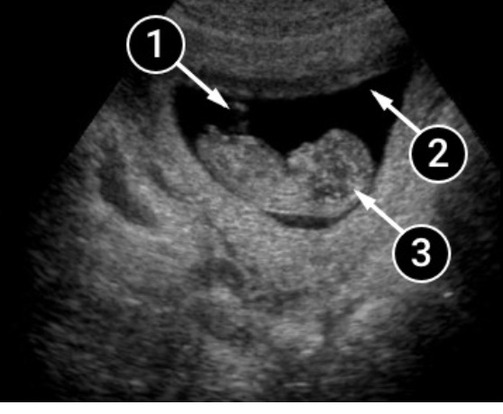 C212D37D BB2B 4704 9DE0 E3F8378AB5BA