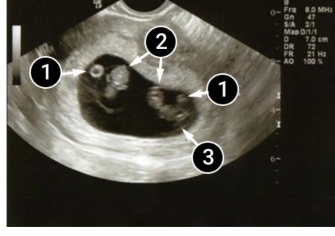 D12A605B 9910 4254 BB1B F29887B02190