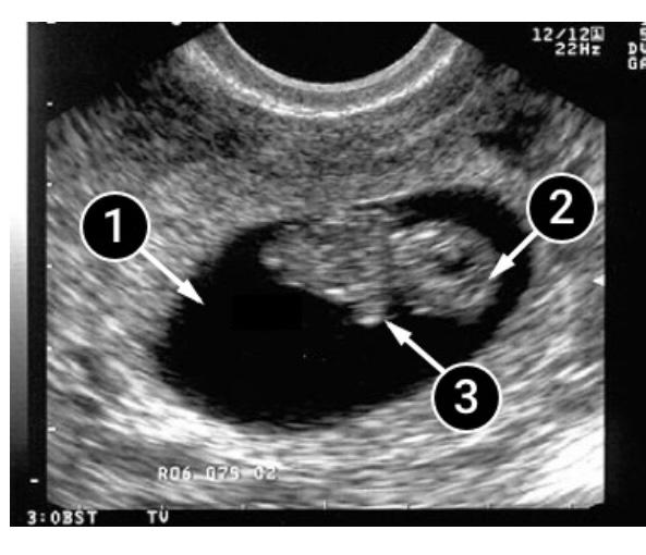 F28161EC EB64 4D49 8395 4C3957C3F960