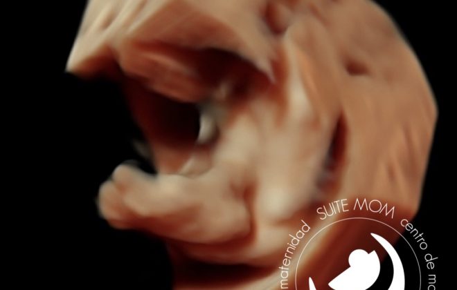 Fetal development: The 2nd trimester - Mayo Clinic