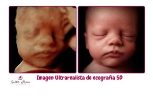 mejor imagen hiperreal ultrarealista con ia de ecografía 5D 4D 3D la mejor calidad mas definicion mejor 8k