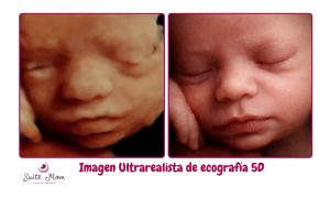 imagen ultrarealista de ecografia