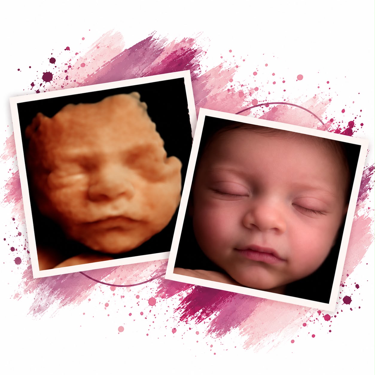 Inicio 21 Ecografia 5D e hiperreal 8k 6D la mejor ecografía cerca de mi ver a mi bebe en ecografía su carita ver la c ara bebe 4D ecografía 5D la mejor calidad el mejor centro de ecografías de todo madrid